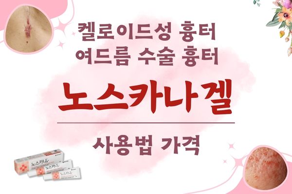 노스카나겔