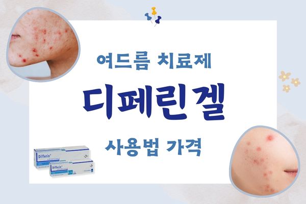 디페린겔