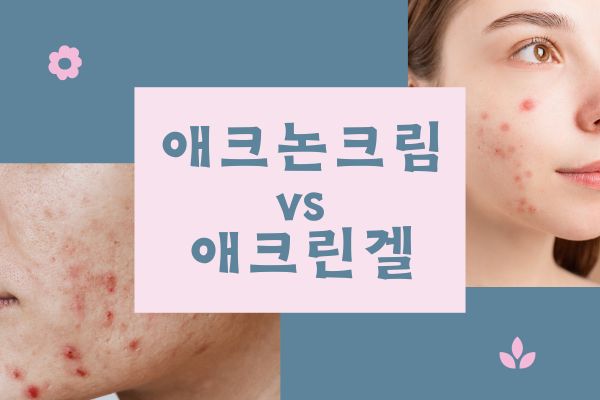 애크논크림과 애크린겔