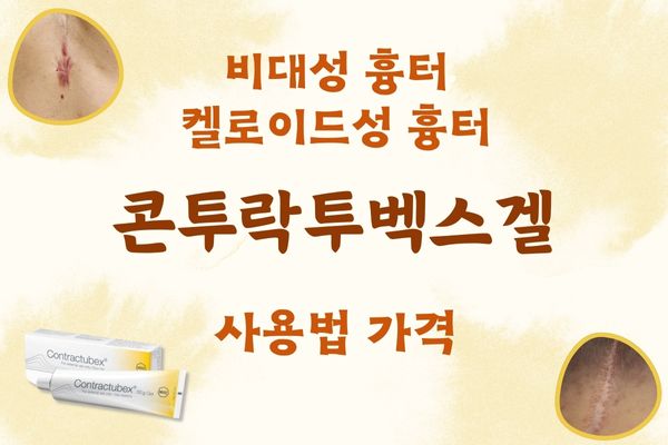 콘투락투벡스겔